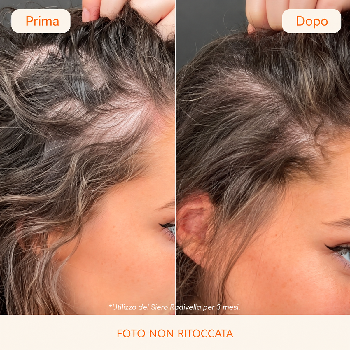 Siero per Capelli Radivella